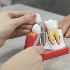 How Do I Know Which Implants Will Better My Oral Health?